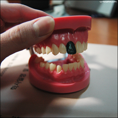 dentiform.jpg